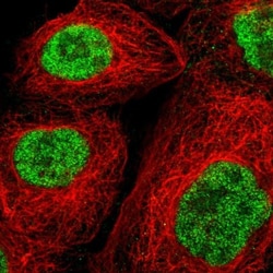 Sperm-associated antigen 7 Antibody, Novus Biologicals 25 &mu;L; Unlabeled:Antibodies,